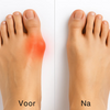 VoetCorrect™ | Corrigeer je tenen, verlicht je pijn