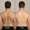 BackBlade Pro™ | Haren moeiteloos verwijderen