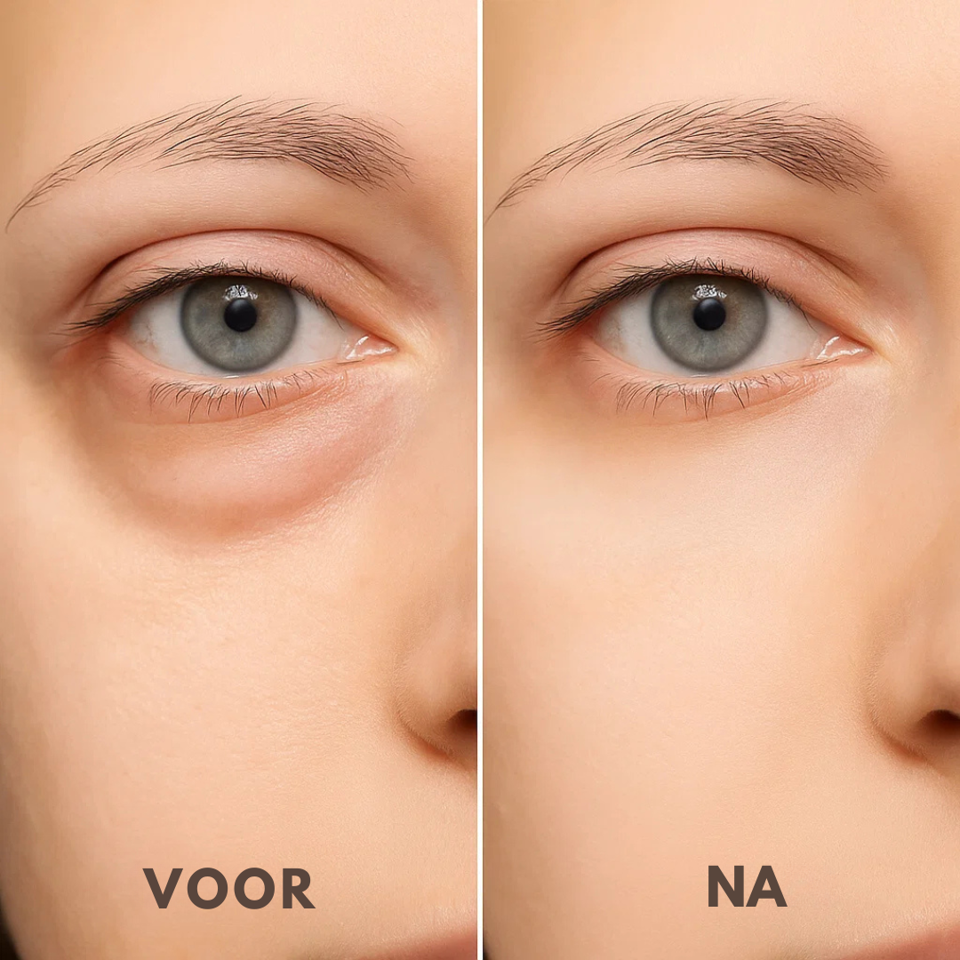 Vezora Eye Crème™ | Zeg maar dag tegen gezwollen ogen!