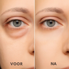 Vezora Eye Crème™ | Zeg maar dag tegen gezwollen ogen!