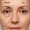 Vezora Eye Crème™ | Zeg maar dag tegen gezwollen ogen!