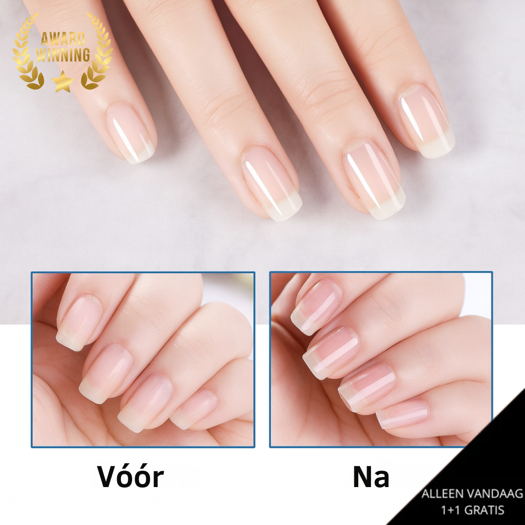 NailRecover™ | Geniet van perfecte nagels zonder te hoeven wachten