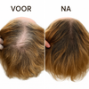 VEGAMOUR GRO| Krijg weer voller en sterker haar
