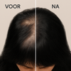 VEGAMOUR GRO| Krijg weer voller en sterker haar