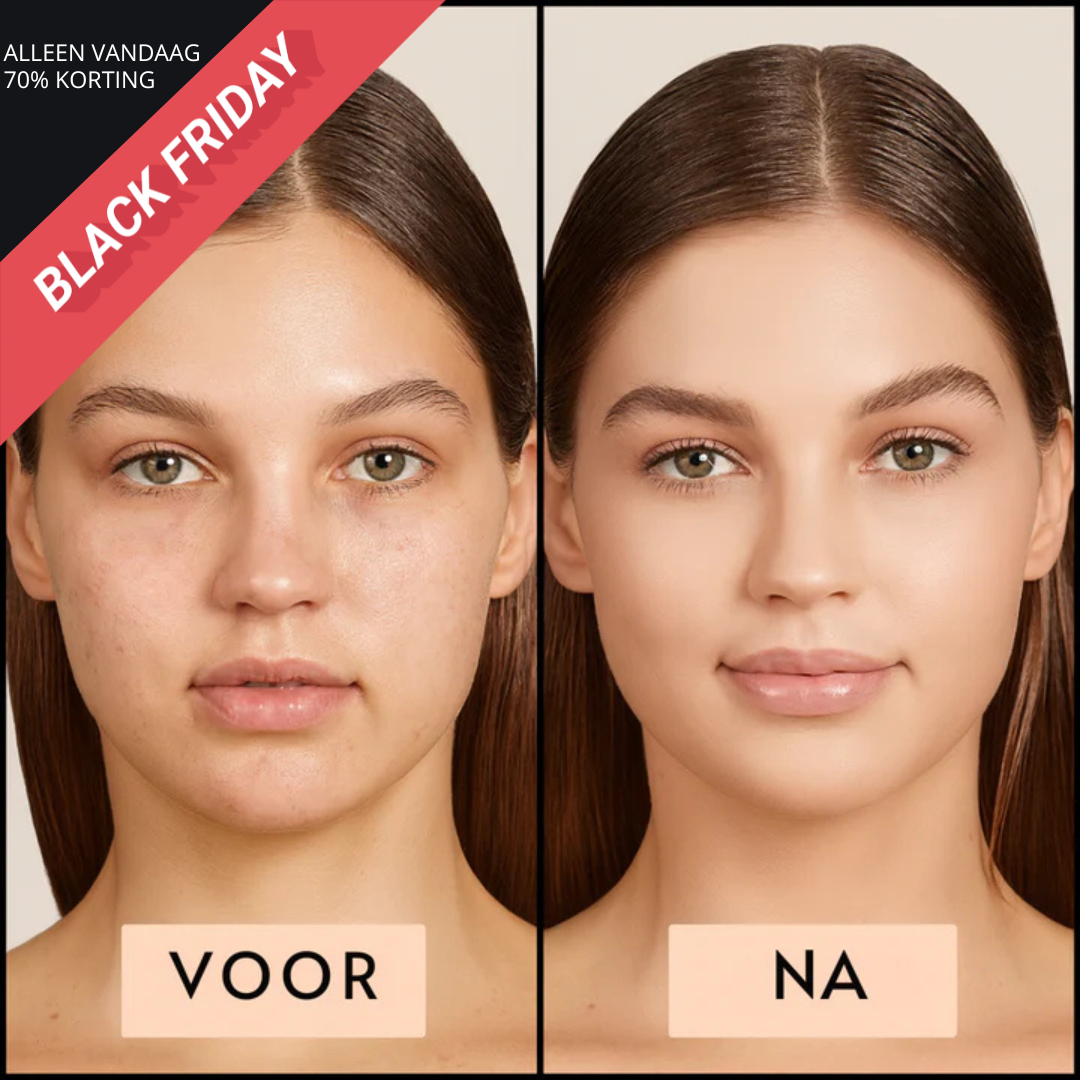 PerfectSkin™ | Altijd een vlekkeloze huid binnen handbereik