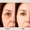 EyeLumé™ | Geniet moeiteloos van stralende, gelifte en jeugdige ogen
